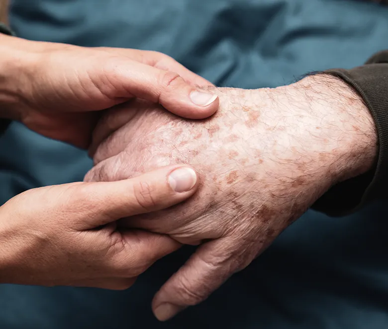 Eine Pflegekraft hält die Hand eines alten Menschen und massiert sie sanft.